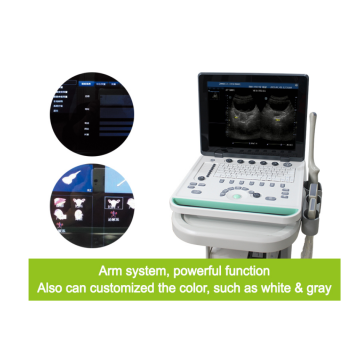 Ultraschallmaschine Laptop für die Klinik